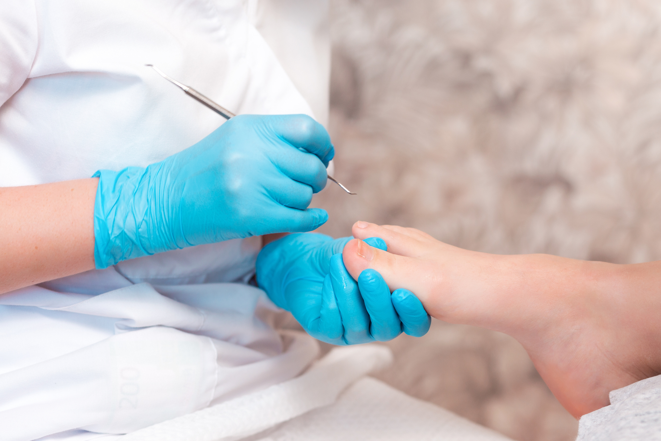 Image of therapist treating the ingrown nail